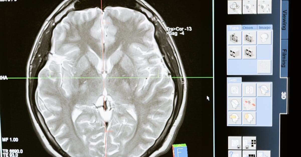 Cover Image for Unlocking Memory: Essential Dementia Tests for Early Detection